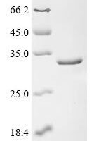 Human Double-stranded RNA-specific adenosine deaminase (ADAR), partial Recombinant Protein, N-GST - BioCrest Sci