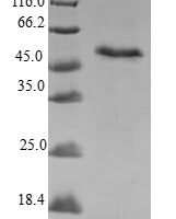 Human Myeloid leukemia factor 1 (MLF1) Recombinant Protein - BioCrest Sci