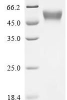 Feline herpesvirus 1 Envelope glycoprotein D (US6), partial Recombinant Protein, C-10His - BioCrest Sci