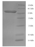 Zaire ebolavirus Pre-small/secreted glycoprotein (GP) Recombinant Protein, N-His-SUMO - BioCrest Sci