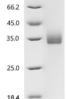 Human B-cell differentiation antigen CD72 (CD72), partial Recombinant Protein - BioCrest Sci