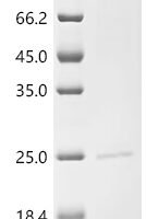 Rat Interleukin-11 (Il11) Recombinant Protein, C-10His - BioCrest Sci