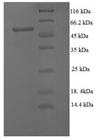 Escherichia coli Modification methylase EcoRV (ecoRVM) Recombinant Protein - BioCrest Sci
