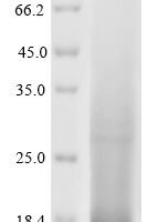 Mouse Lymphocyte antigen 6G (Ly6g), partial Recombinant Protein - BioCrest Sci