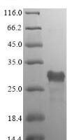 Bacillus subtilis S-ribosylhomocysteine lyase (luxS) Recombinant Protein - BioCrest Sci