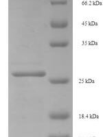 Human C-Myc-binding protein (MYCBP) Recombinant Protein - BioCrest Sci