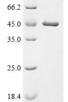 Enterobacteria phage T4 RNA ligase 2 (Y10A) Recombinant Protein - BioCrest Sci