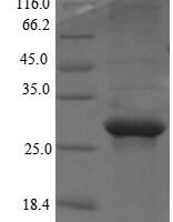 Human Mediator of RNA polymerase II transcription subunit 1 (MED1), partial Recombinant Protein - BioCrest Sci