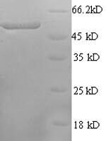 Rat Calcium/calmodulin-dependent protein kinase type IV (Camk4) Recombinant Protein - BioCrest Sci