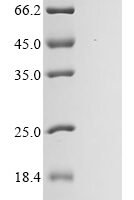 Escherichia coli Ribonuclease E (rne), partial Recombinant Protein - BioCrest Sci