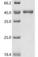 Candida albicans Secreted aspartic protease 5 (SAP5) Recombinant Protein - BioCrest Sci