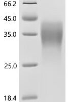 Mouse Fos-related antigen 1 (Fosl1) Recombinant Protein, C-His - BioCrest Sci