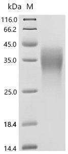 Mouse Fos-related antigen 1 (Fosl1) Recombinant Protein, C-His, Mus musculus (Mouse), Yeast, C-terminal 6xHis-tagged, 31.3 kDa, purity >≥ 95% as determined by SDS-PAGE.
