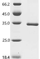 Dog tissue kallikrein (KLK5), partial Recombinant Protein, C-His - BioCrest Sci
