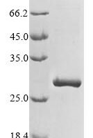 Tetronarce californica Acetylcholine receptor subunit alpha (CHRNA1), partial Recombinant Protein, C-His, aa 25–234, Baculovirus - BioCrest Sci