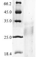 Human Ribonuclease T2 (RNASET2) Recombinant Protein - BioCrest Sci