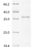 Human IgGFc-binding protein (FCGBP), partial Recombinant Protein - BioCrest Sci