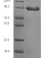 Human Neuronal migration protein doublecortin (DCX) Recombinant Protein - BioCrest Sci