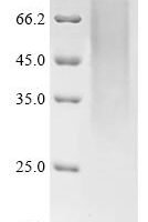 Mouse Transmembrane protein 106B (Tmem106b), partial Recombinant Protein - BioCrest Sci