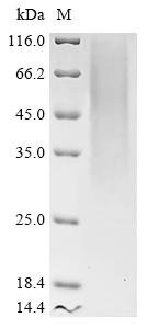 Mouse Transmembrane protein 106B (Tmem106b), partial Recombinant Protein, Mus musculus (Mouse), Yeast, C-terminal 6xHis-tagged, 19.6 kDa, purity >≥ 85% as determined by SDS-PAGE.