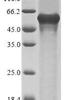 Human Isthmin-1 (ISM1) Recombinant Protein - BioCrest Sci