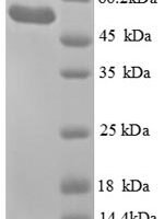 Escherichia coli Glycerol kinase (glpK) Recombinant Protein - BioCrest Sci