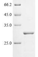 Rat Stathmin-2 (Stmn2) Recombinant Protein - BioCrest Sci