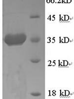 Human Endoplasmic reticulum chaperone BiP (HSPA5), partial Recombinant Protein - BioCrest Sci
