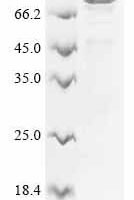 Human Mucin-7 (MUC7) Recombinant Protein - BioCrest Sci