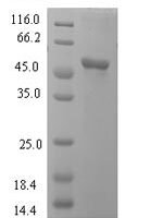 Human L-lactate dehydrogenase C chain (LDHC), partial Recombinant Protein, N-His-SUMO - BioCrest Sci