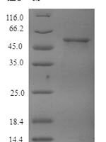 Human Tubulin beta-4A chain (TUBB4A) Recombinant Protein, N-His, aa 1–444, E.coli - BioCrest Sci