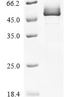 Human Lipoyl synthase, mitochondrial (LIAS) Recombinant Protein, C-His - BioCrest Sci