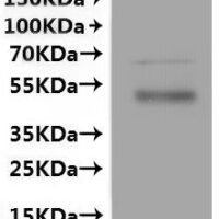 Human Monocarboxylate transporter 6 (SLC16A5)-VLPs Recombinant Protein - BioCrest Sci