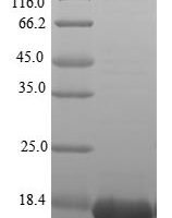 Human Tumor necrosis factor (TNF), partial Recombinant Protein - BioCrest Sci