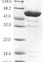 Human Prohibitin-2 (PHB2) Recombinant Protein, N-GST - BioCrest Sci