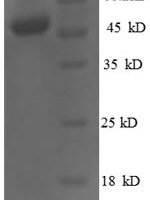 Human Homeobox protein OTX2 (OTX2) Recombinant Protein - BioCrest Sci