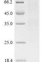 Metamycoplasma hominis Arginine deiminase (arcA)(P210S) Recombinant Protein - BioCrest Sci