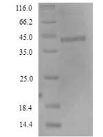 Human Fc receptor-like protein 4 (FCRL4), partial Recombinant Protein, N-His - BioCrest Sci