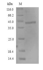 Human Fc receptor-like protein 4 (FCRL4), partial Recombinant Protein, N-His, Homo sapiens (Human), Yeast, N-terminal 6xHis-tagged, 43.6 kDa, purity >≥ 90% as determined by SDS-PAGE.