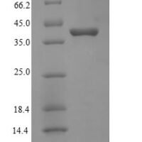 Human Protein Wnt-2 (WNT2) Recombinant Protein, N-His, aa 26–360, E.coli - BioCrest Sci