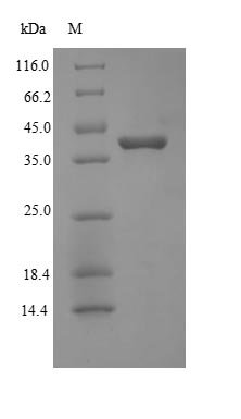 Human Protein Wnt-2 (WNT2) Recombinant Protein, N-His, aa 26–360, E.coli, Homo sapiens (Human), E.coli, N-terminal 6xHis-tagged, 41.6 kDa, purity >≥ 90% as determined by SDS-PAGE.