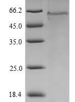 Mouse Serine/threonine-protein kinase VRK1 (Vrk1) Recombinant Protein - BioCrest Sci