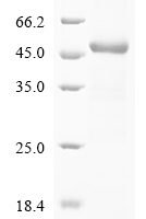 Human Transient receptor potential cation channel subfamily V member 1 (TRPV1), partial Recombinant Protein - BioCrest Sci