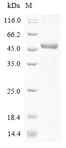 Human Transient receptor potential cation channel subfamily V member 1 (TRPV1), partial Recombinant Protein, Homo sapiens (Human), E.coli, N-terminal 6xHis-GST-tagged, 48.4 kDa, purity >≥ 85% as determined by SDS-PAGE.