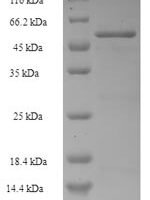 Escherichia coli Methyl-accepting chemotaxis protein II (tar), partial Recombinant Protein - BioCrest Sci