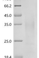 Human Interferon gamma (IFNG) Recombinant Protein, C-10His - BioCrest Sci