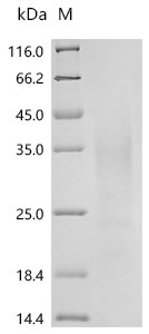 Human Interferon gamma (IFNG) Recombinant Protein, C-10His, Homo sapiens (Human), Yeast, C-terminal 10xHis-tagged, 18.8 kDa, purity >≥ 95% as determined by SDS-PAGE.