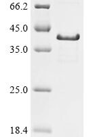Mesocricetus auratus Syndecan-1 (SDC1), partial Recombinant Protein - BioCrest Sci