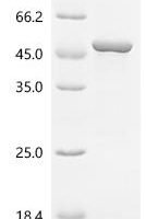 Human Actin-related protein 2 (ACTR2) Recombinant Protein - BioCrest Sci