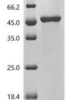 Human Lysosomal phospholipase A and acyltransferase (PLA2G15) Recombinant Protein - BioCrest Sci